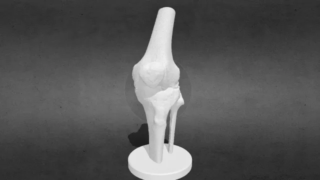 真实CT扫描的解剖学膝盖模型stl.stl